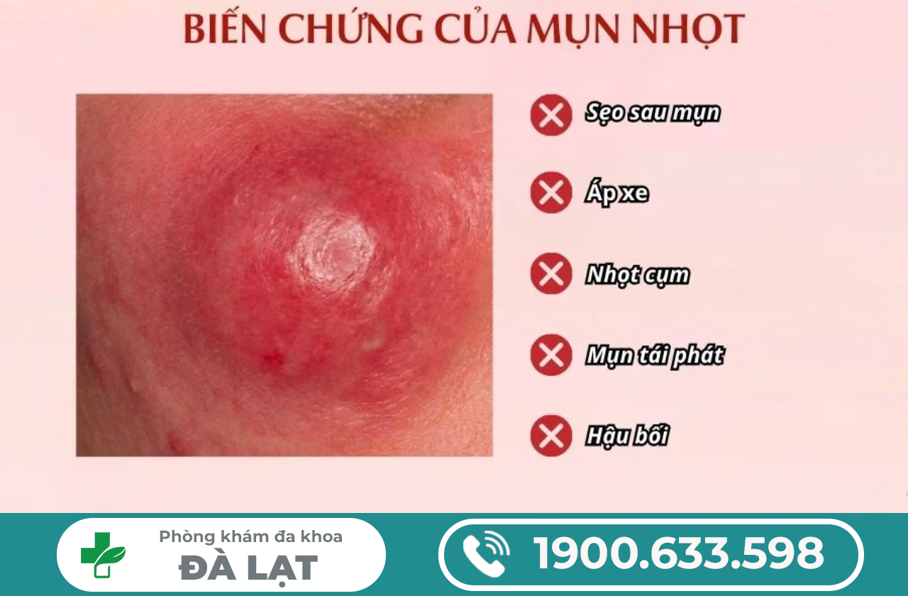 Hình ảnh minh họa